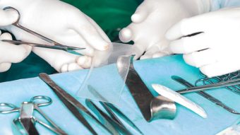 Is Mesh Safe for hernia surgery?