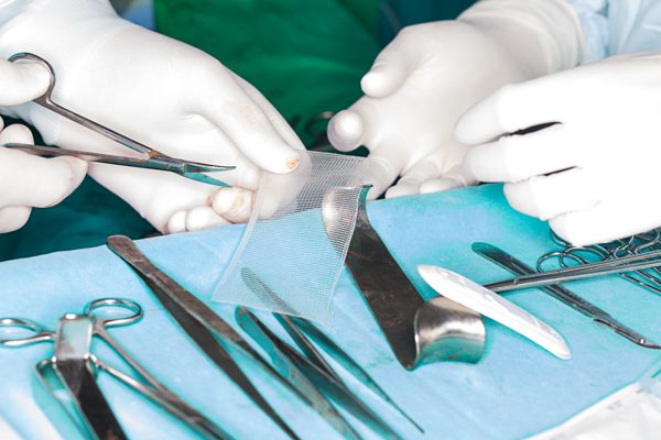Is Mesh Safe for hernia surgery?