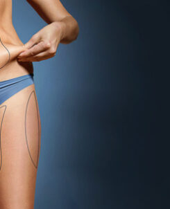 Get rid of unwanted bulges!